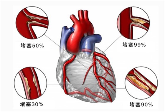 关注雾霾资讯