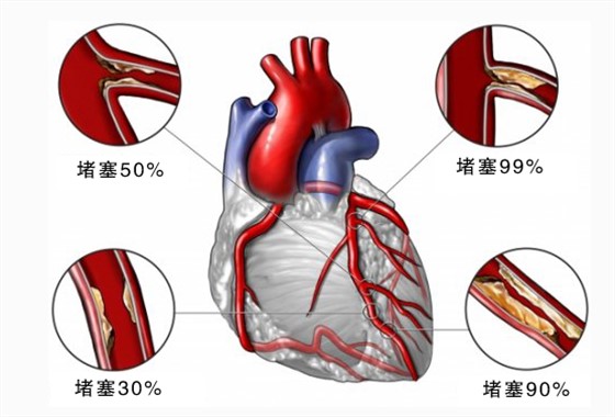 关注雾霾资讯